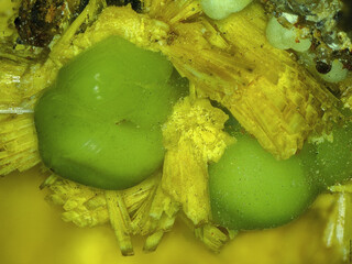 Deutschland/Sachsen/Erzgebirgskreis/Schneeberg, Lagerstätte/Neustädtel/Weißer Hirsch (Schacht 3)